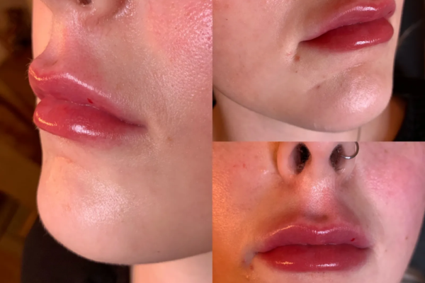 rs=w_2600px,h_1600px (11)