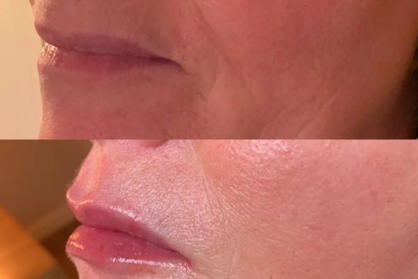 rs=w_2600px,h_1600px (13)