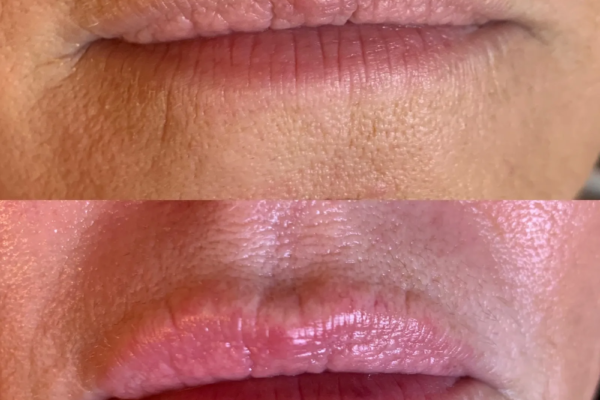 rs=w_2600px,h_1600px (14)