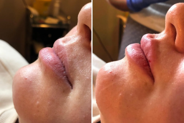 rs=w_2600px,h_1600px (3)