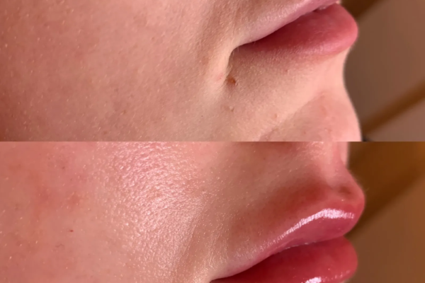 rs=w_2600px,h_1600px (4)