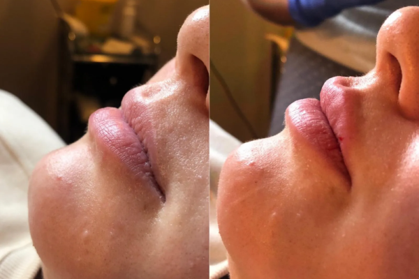 rs=w_2600px,h_1600px (5)