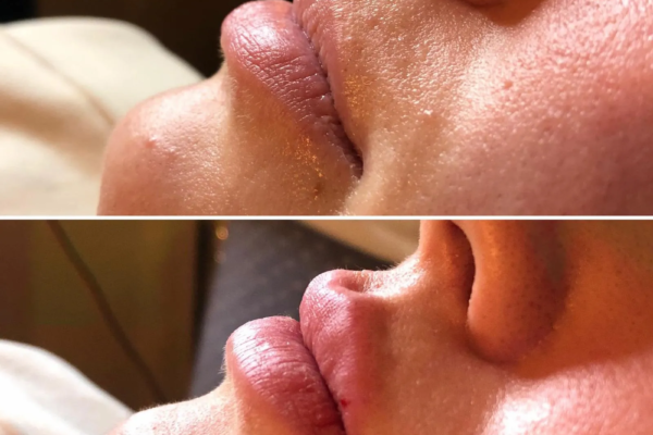 rs=w_2600px,h_1600px (6)