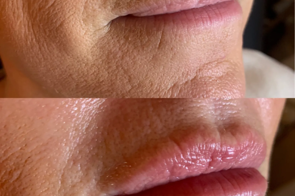 rs=w_2600px,h_1600px