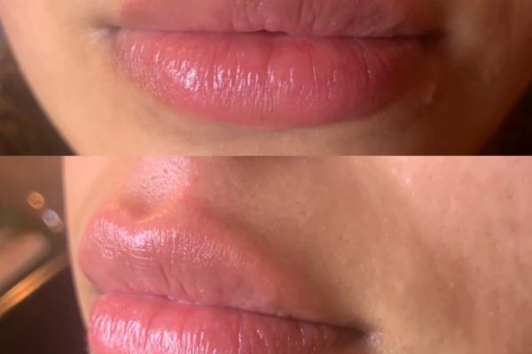 rs=w_2600px,h_1600px (8)