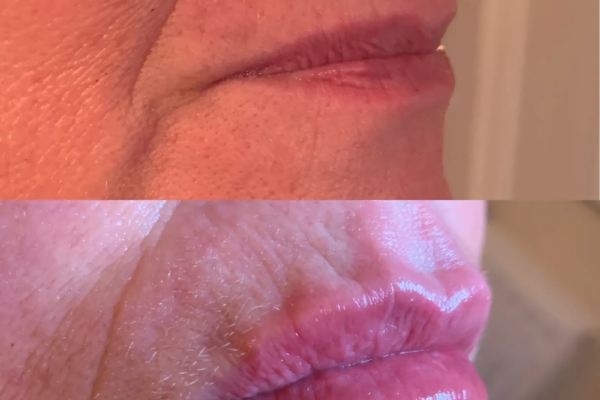 rs=w_2600px,h_1600px (9)